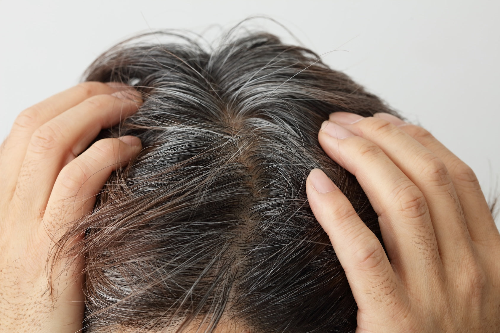 A Topical Formulation That Reverses Premature Hair Graying?