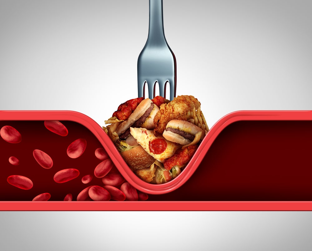 Is There Really An Anti-Inflammatory Diet?