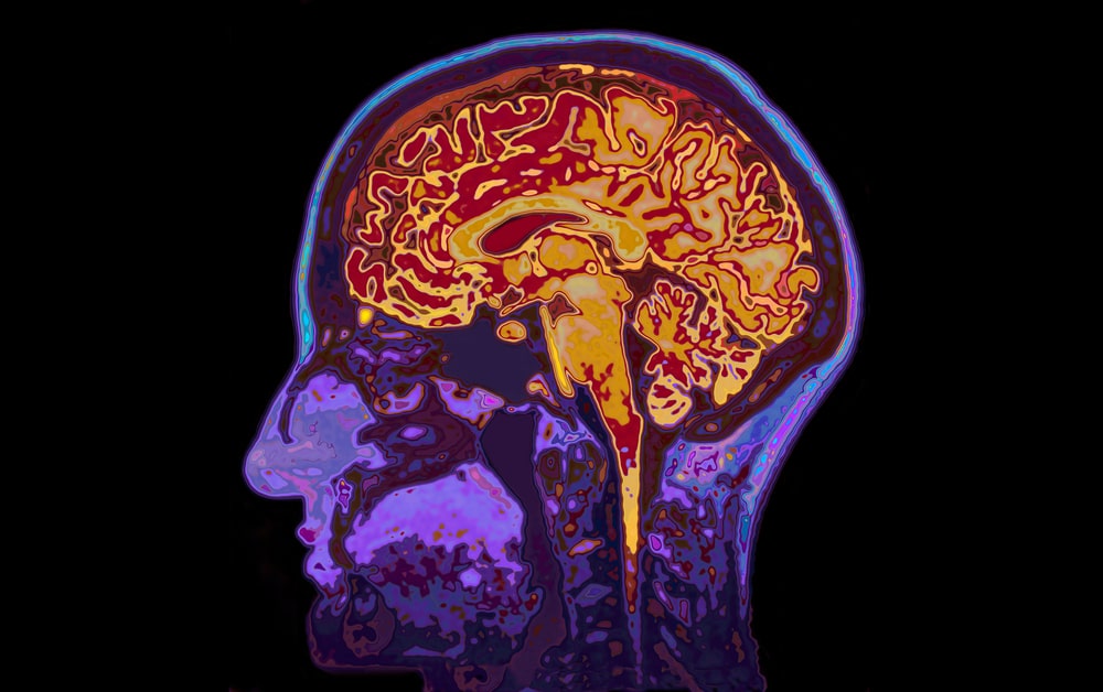 New Evidence Explains Why The Brain Is Such A Fuel Guzzler